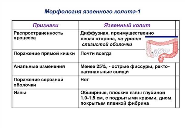 Почему это важно?