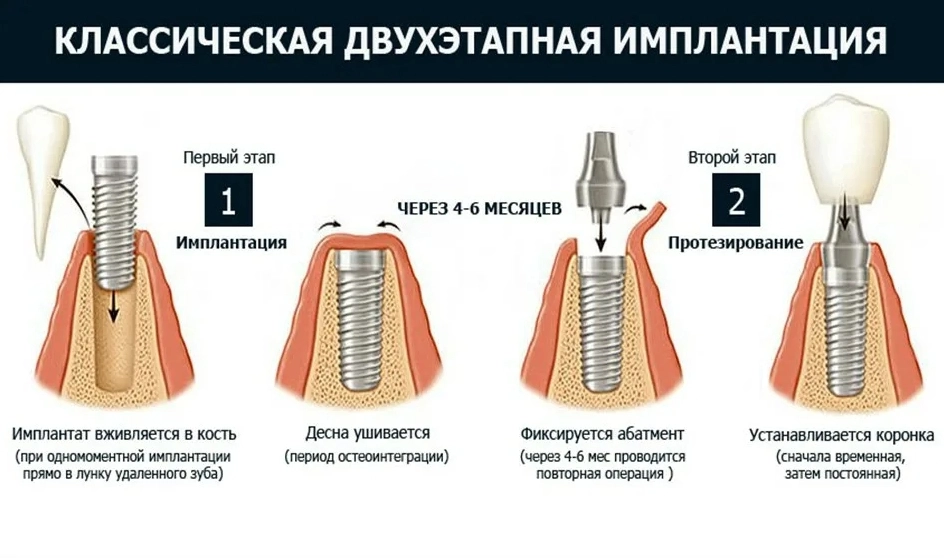 3. Развитие методов компьютерной навигации