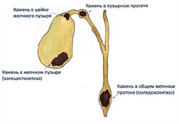 Желтушность