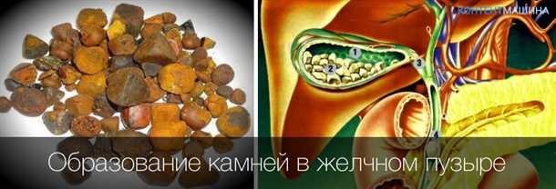 Правильное питание