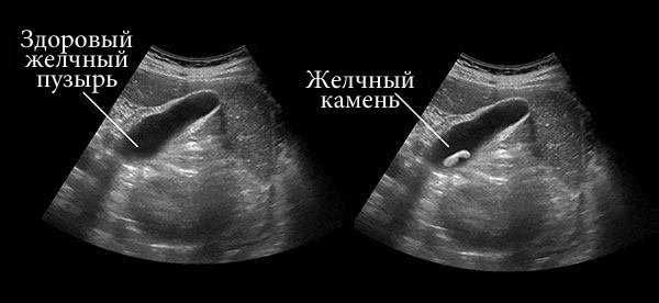 Доктор Смирнова, гастроэнтеролог: