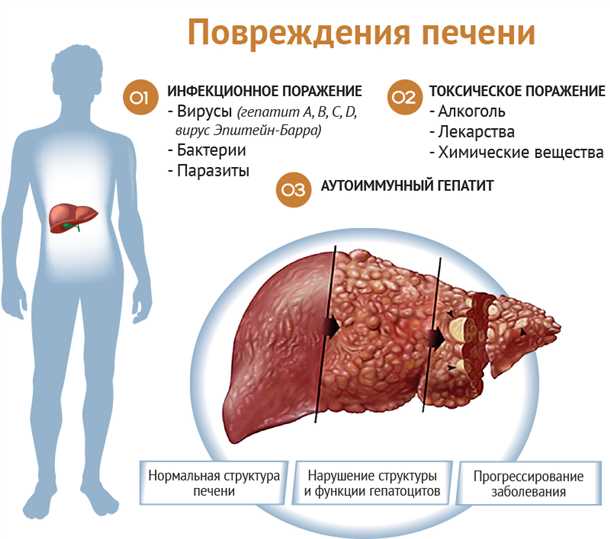 Преимущества лечения печени в России