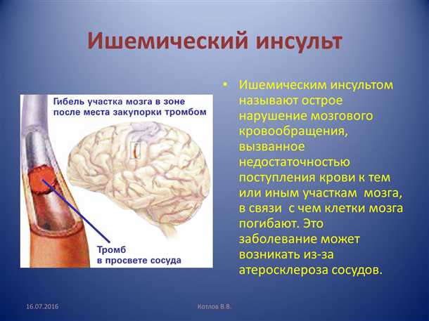 Речевые нарушения