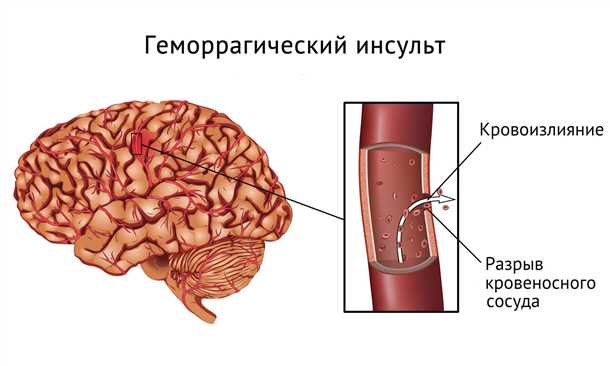 Психологические и социальные последствия