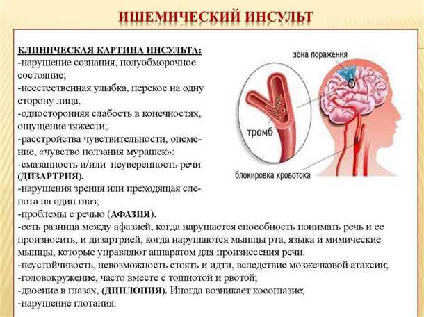 Эмболия