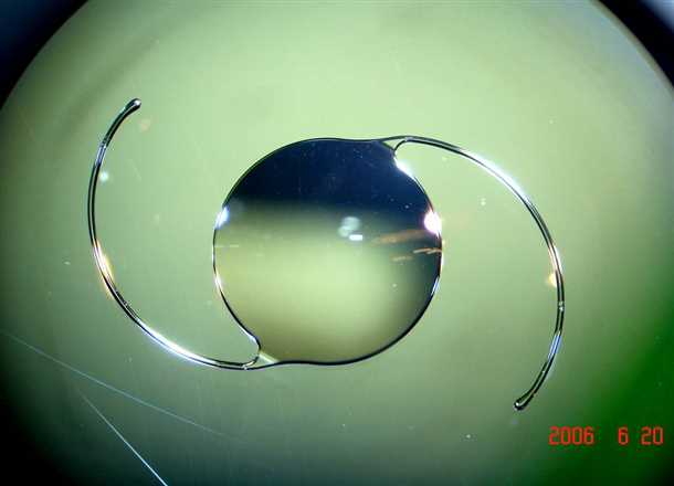 Типы ИОЛ для коррекции близорукости