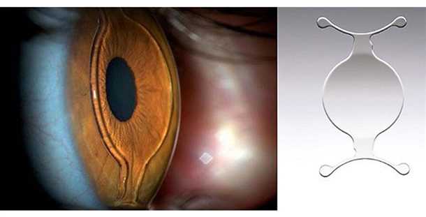 Принцип работы