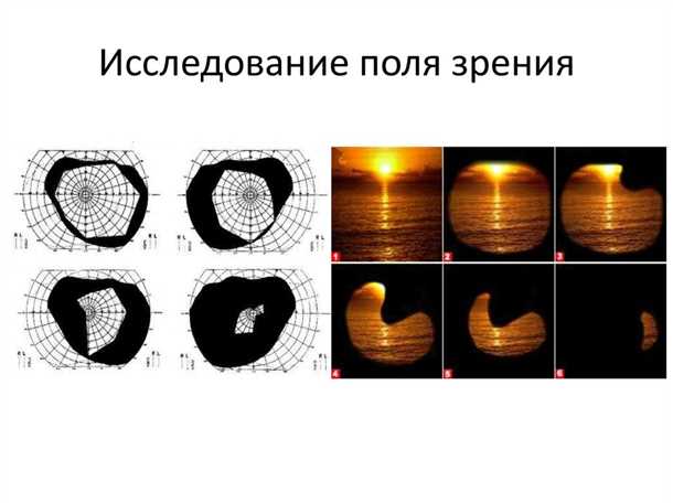 Почему важно проводить обследование глаз?