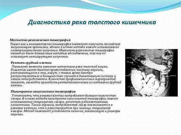 6. Виртуальная колоноскопия (КТ-колоноскопия)