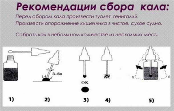 Как правильно собрать кал на анализ: подробная инструкция | Медицинская ...