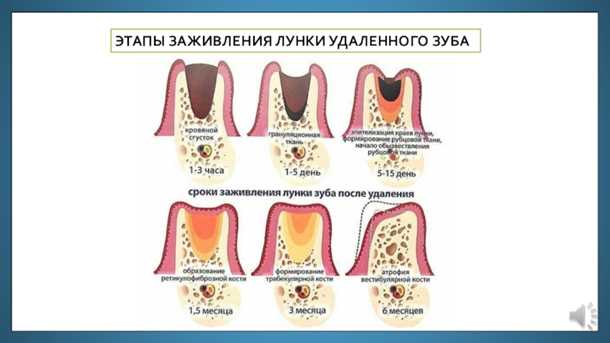 Образование раны