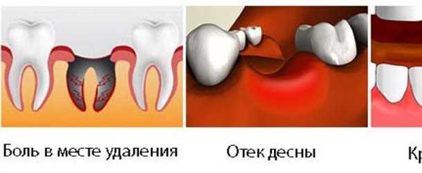 Усиление болевых ощущений