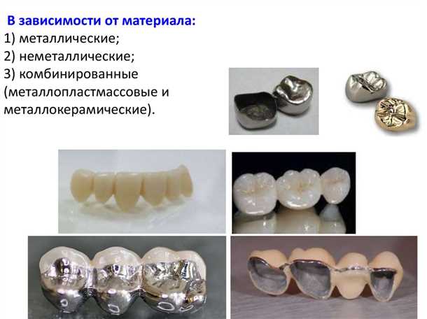 Композитные коронки: доступное решение