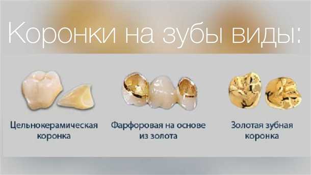 Какие коронки на зубы лучше