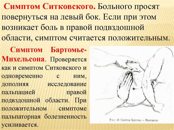 Учащенное мочеиспускание при аппендиците: причины и симптомы