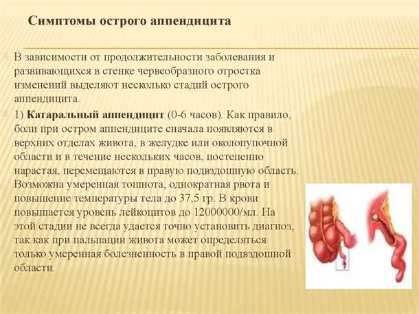Повышение температуры при аппендиците