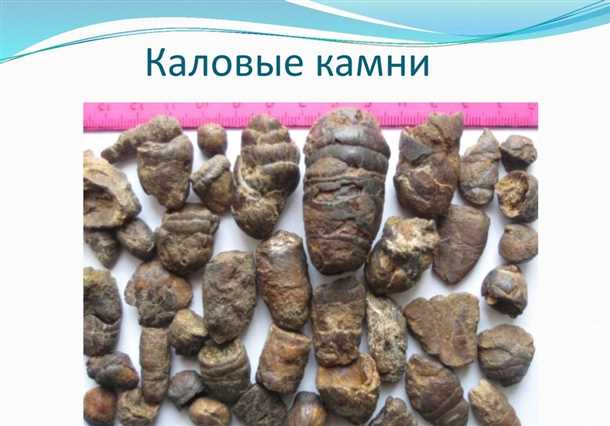 3. Избегать длительного удержания стула