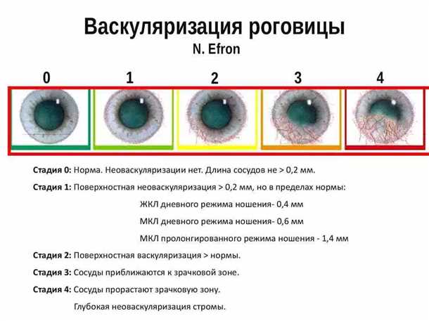 Последствия и возможные осложнения при кератите