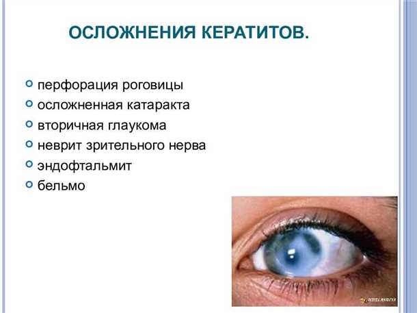 Причины кератита