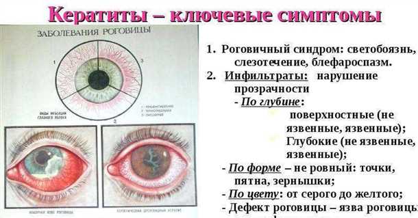 Лечение кератита: методы и рекомендации