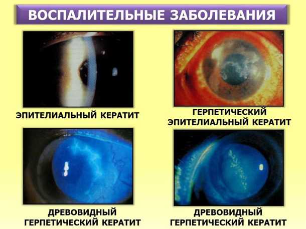 1. Соблюдайте личную гигиену