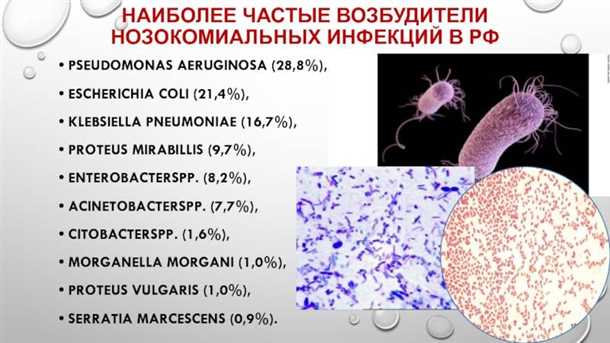 Правила профилактики клебсиеллы в кишечнике