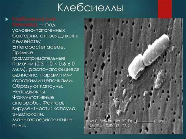 Правила профилактики клебсиеллы в кишечнике