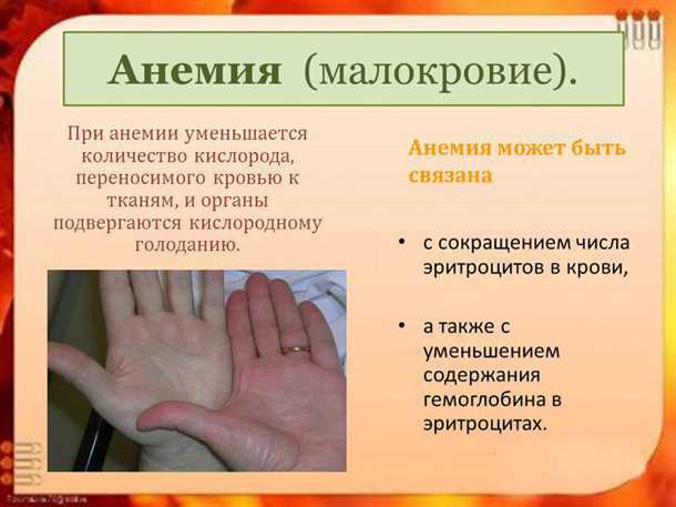Конвульсивные состояния и анемия: влияние недостатка кислорода на функцию нервной системы и лечение.