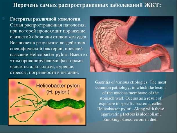 Болезни желудочно-кишечного тракта: классификация и симптомы