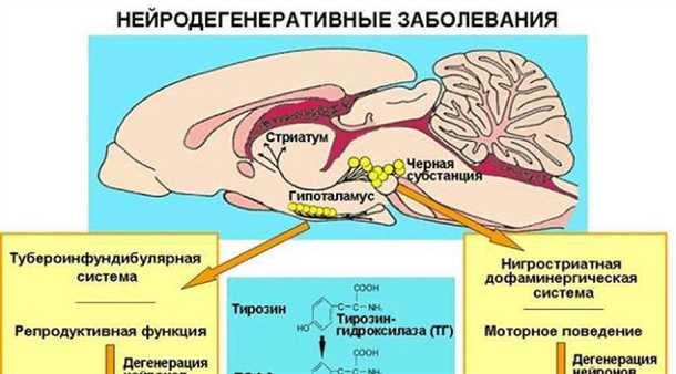 Конвульсивные состояния и нейродегенеративные заболевания: синдромы и терапия.