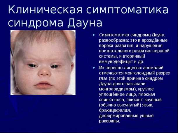 Конвульсивные состояния и врожденные пороки развития: аномалии и лечение.