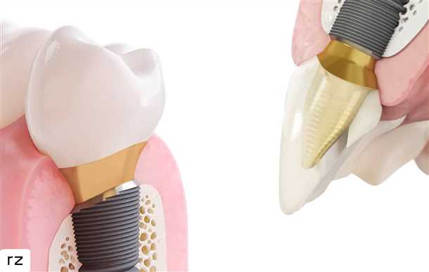 2. Помостовые дефекты