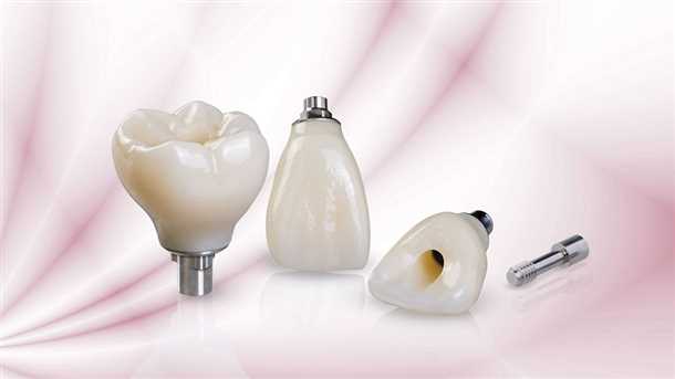 Материалы для коронки на имплант