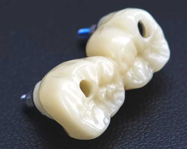 1. Подготовка и оформление имплантов