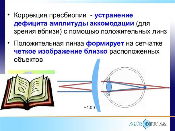 Коррекция пресбиопии