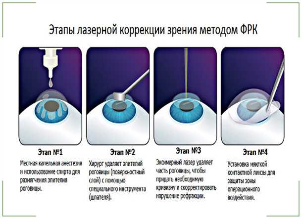 Методы коррекции зрения без хирургического вмешательства