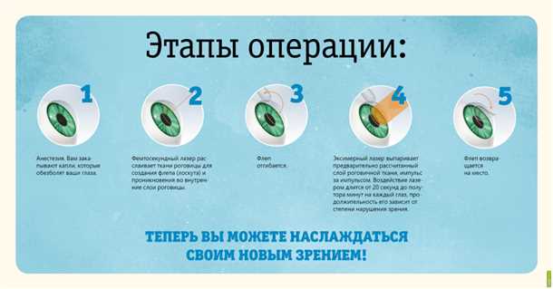 Контактные линзы