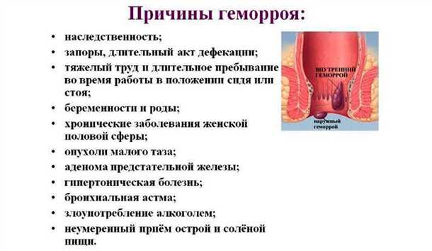 Причины и симптомы