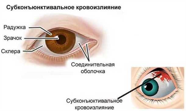 1. Прекратить физическую активность