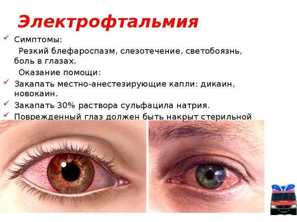 Кровоизлияние в глаз, лечение (что делать), причины, симптомы, профилактика.