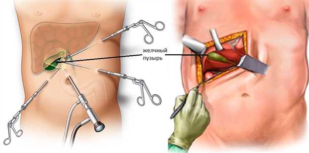 Уход за раной