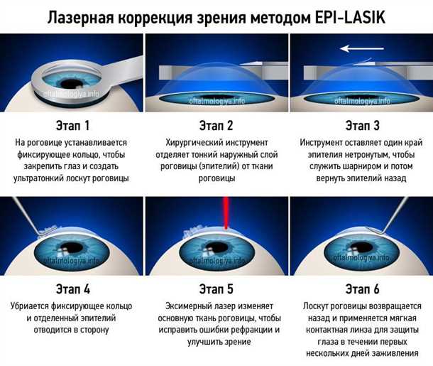 1. Быстрое восстановление зрения