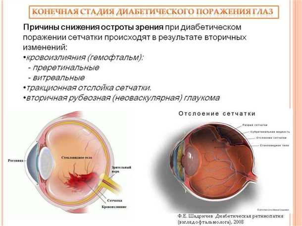 Использование препаратов для лечения