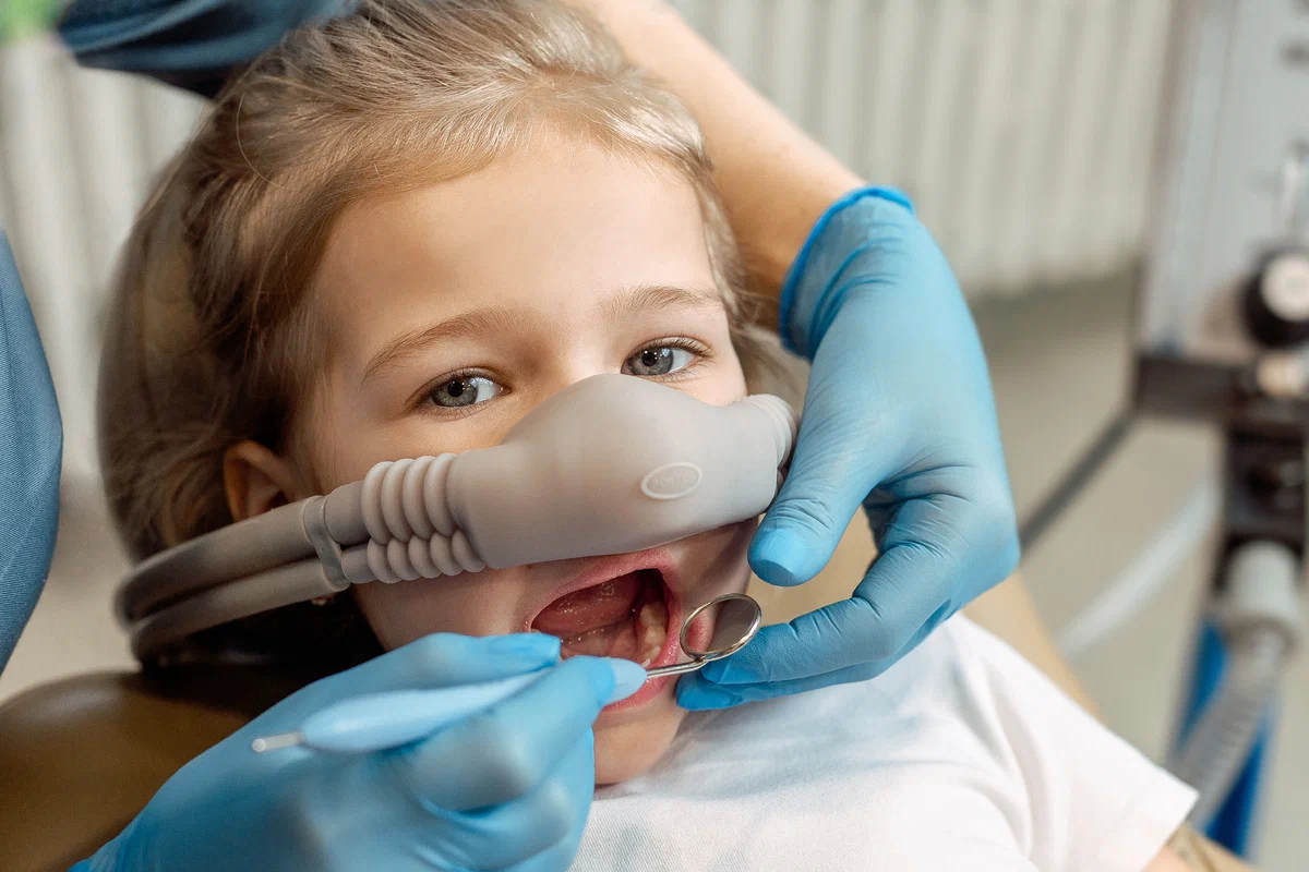 Наркоз в стоматологии для детей. Закись азота в стоматологии для детей. Закись азота в стоматологии для детей. Что такое седация у ребенка. Садотация для ребенка.
