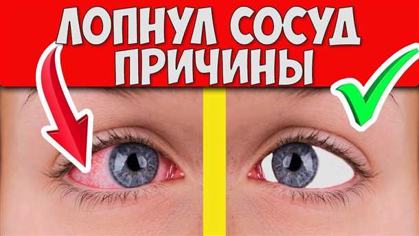 2. Травма