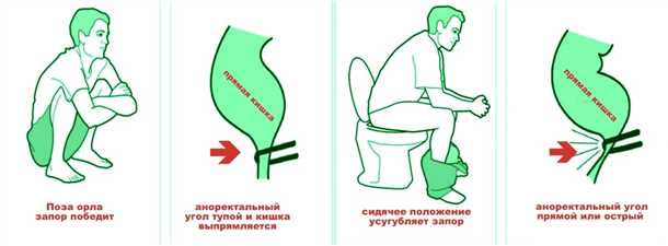 Причины ложных позывов к дефекации