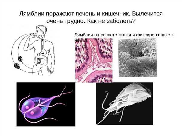 Как избежать заражения лямблиями печени?