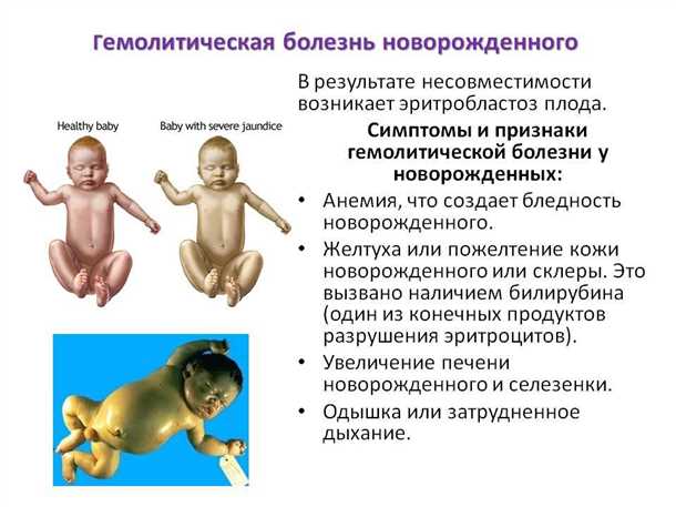 Проблемы с выходом мекония: что может случиться?