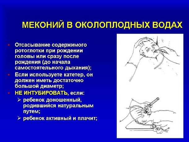 Влияние мекония на ребенка