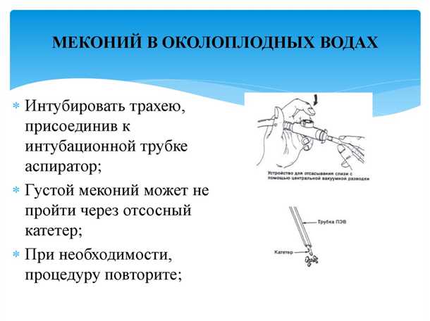 Меконий в околоплодных водах: опасность состояния для ребенка и лечение